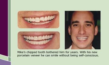 Why Danforth Dental Care 