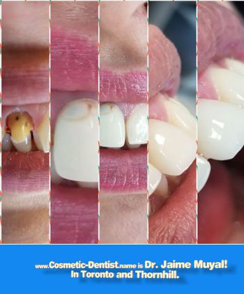 Cosmetic Dentist Name is Dr. Jaime Muyal in Toronto